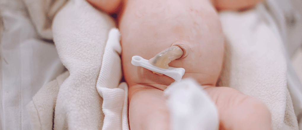 Knowing How To Take Care Of Your Baby’s Umbilical Cord