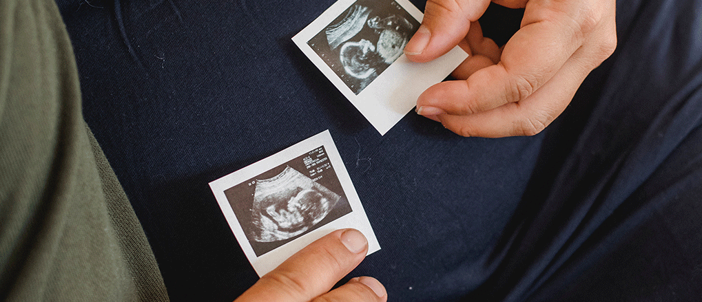 Understanding Stillbirth: Causes, Symptoms, and Prevention